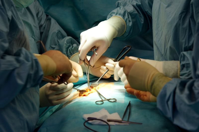 Laparoscopy Surgery in Nagpur
